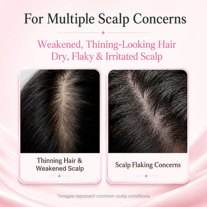 Sonvya Botanical Scalp Renewal Serum