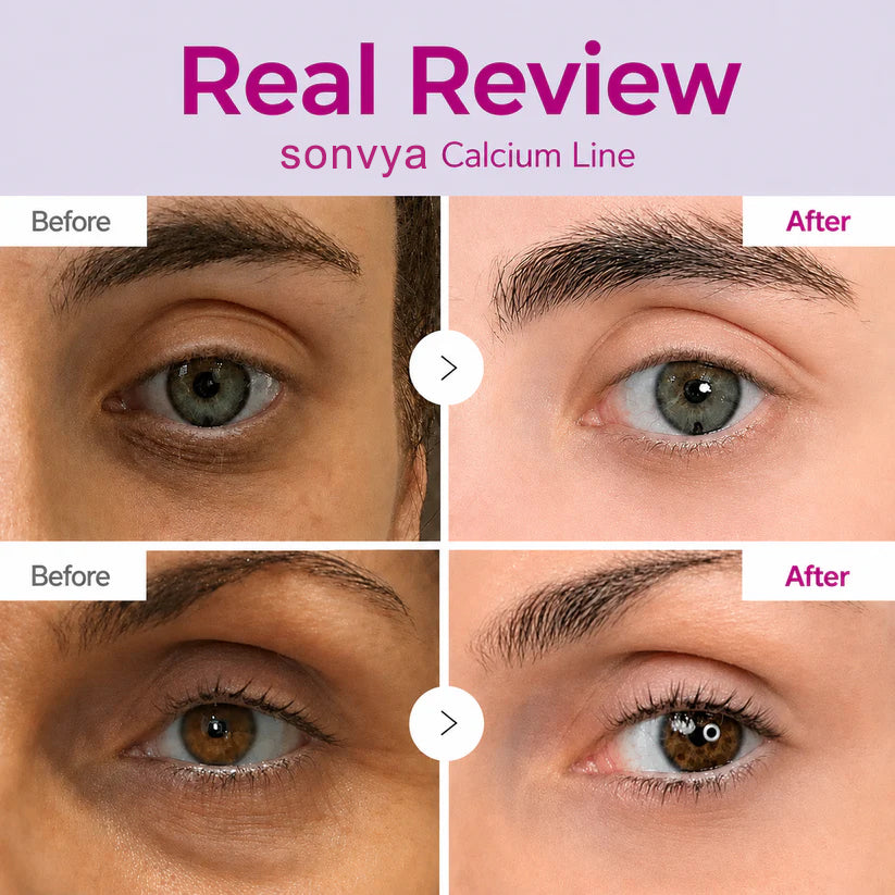 🔥LAST DAY 50% OFF!!Sonvya Korean Calcium Dark Spot Eye Cream