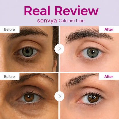 🔥LAST DAY 50% OFF!!Sonvya Korean Calcium Dark Spot Eye Cream